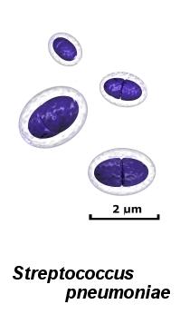 Gram positive diplococci drawing